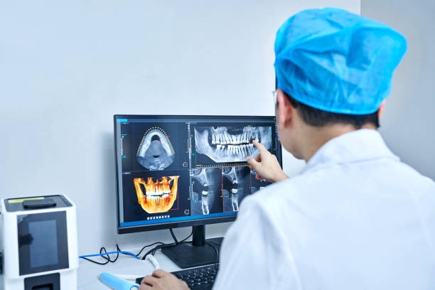 Best Emergency Dentist for Lost Fillings or Crowns in Munford, AL